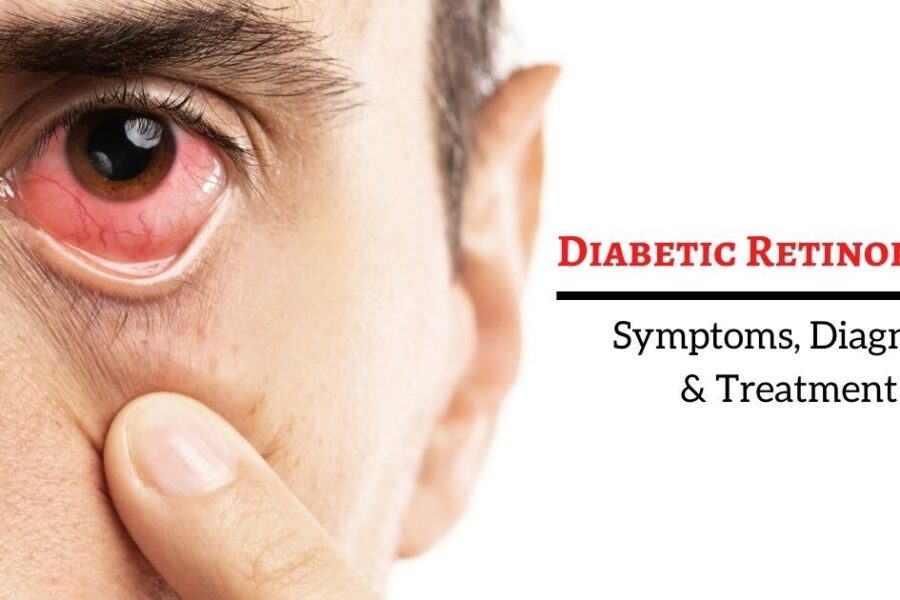 Diabetic-retinapathy-treatment-in-mumbai-945x630