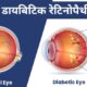 Diabetic-Retinopathy-900x450