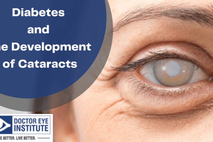 Diabetes-and-the-Development-of-Cataracts-990x660