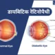 Diabetic-Retinopathy