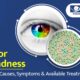 Color Blindness: Understanding the Condition and Available Treatments