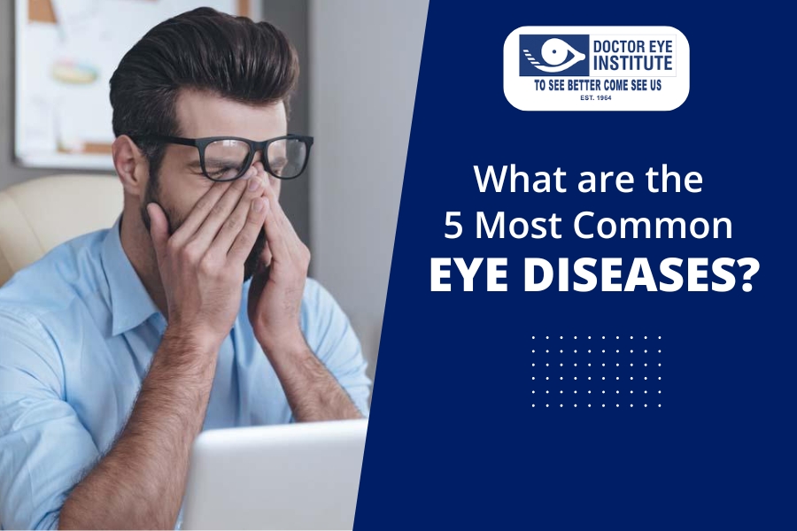 What are the common eye diseases