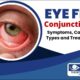 Eye Flu Conjunctivitis