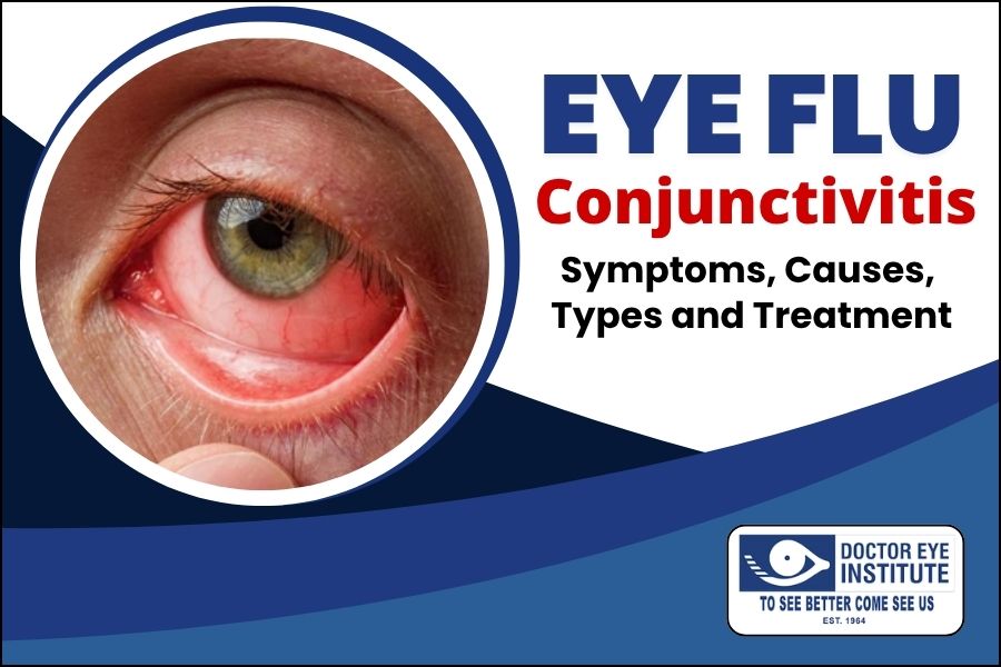 Eye Flu Conjunctivitis