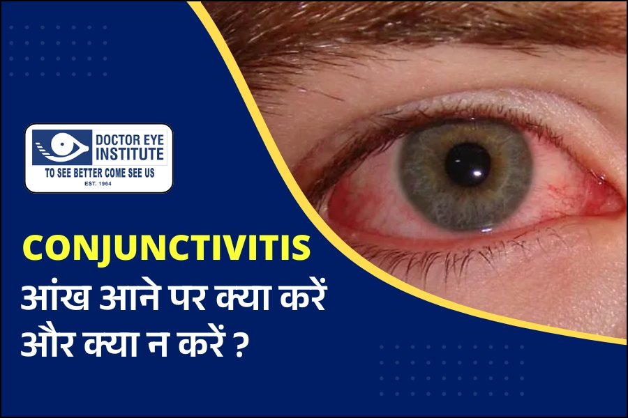 आंख आने पर क्या करें और क्या न करें?